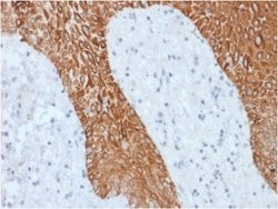 Cytokeratin, pan Antibody (KRT/1877R) - Azide and BSA Free, Novus Biologicals 100 &mu;g | Buy Online | Novus Biologicals | Fisher Scientific